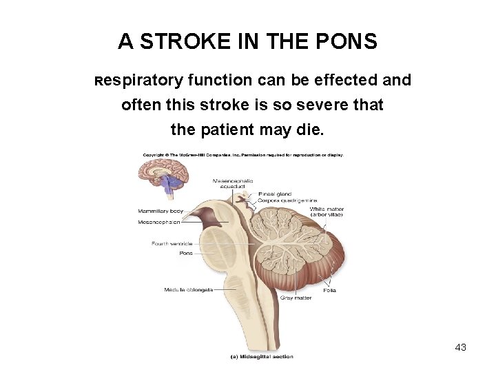 A STROKE IN THE PONS Respiratory function can be effected and often this stroke