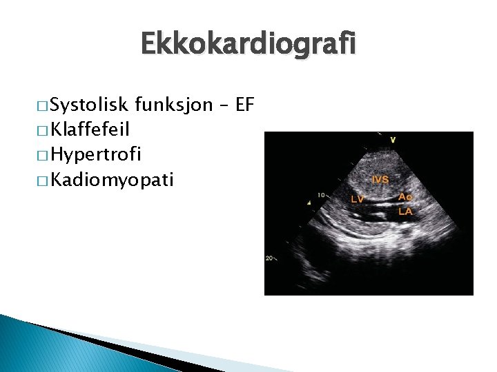 Ekkokardiografi � Systolisk � Klaffefeil funksjon – EF � Hypertrofi � Kadiomyopati 