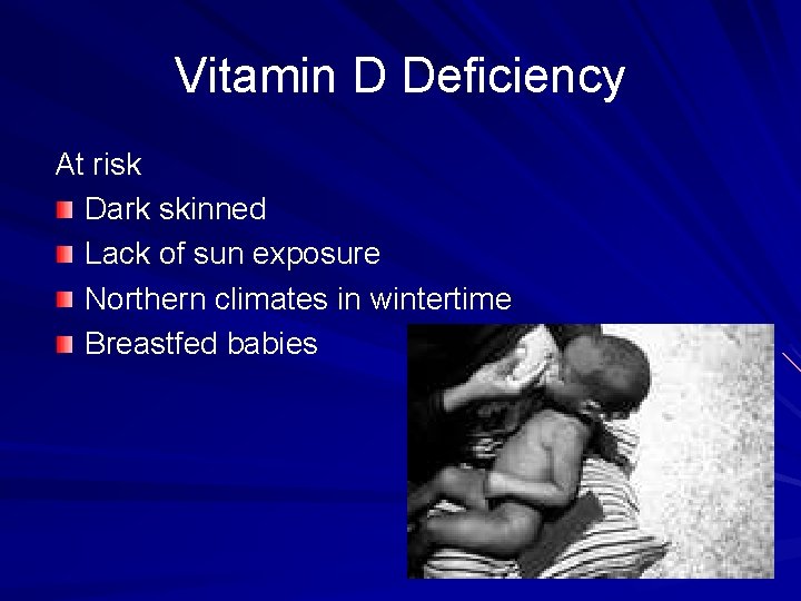 Vitamin D Deficiency At risk Dark skinned Lack of sun exposure Northern climates in
