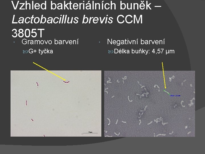 Vzhled bakteriálních buněk – Lactobacillus brevis CCM 3805 T Gramovo barvení G+ tyčka Negativní