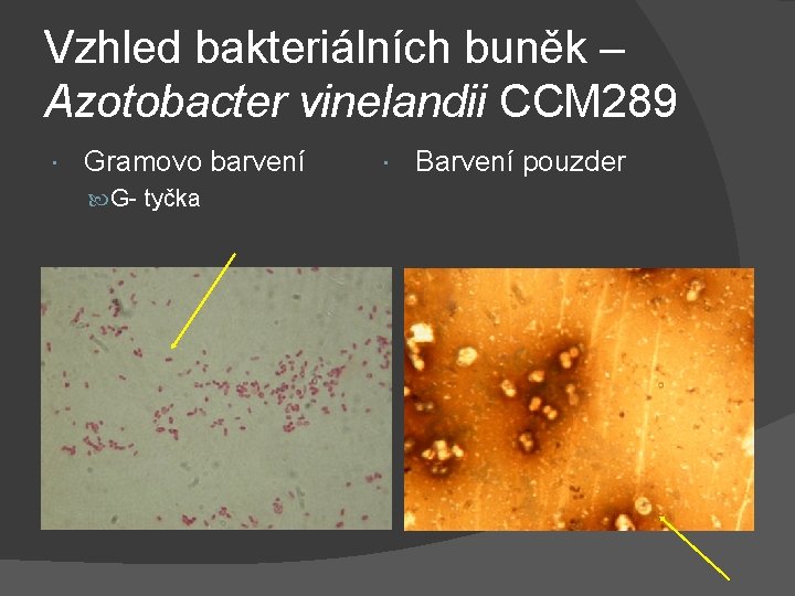 Vzhled bakteriálních buněk – Azotobacter vinelandii CCM 289 Gramovo barvení G- tyčka Barvení pouzder