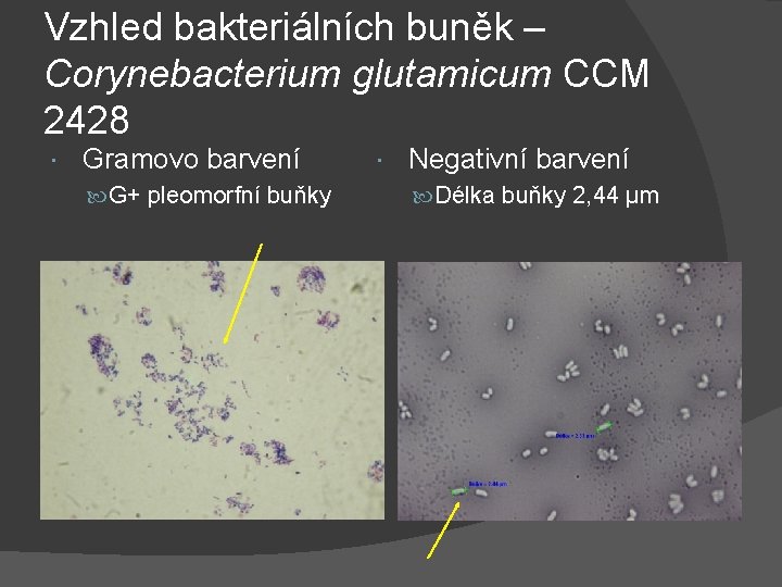 Vzhled bakteriálních buněk – Corynebacterium glutamicum CCM 2428 Gramovo barvení G+ pleomorfní buňky Negativní
