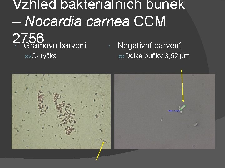 Vzhled bakteriálních buněk – Nocardia carnea CCM 2756 Gramovo barvení Negativní barvení G- tyčka