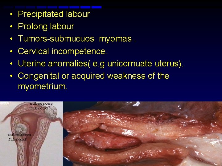  • • • Precipitated labour Prolong labour Tumors-submucuos myomas. Cervical incompetence. Uterine anomalies(