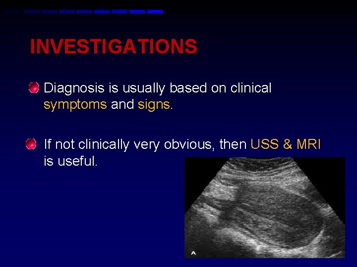 INVESTIGATIONS • Diagnosis is usually based on clinical symptoms and signs. • If not