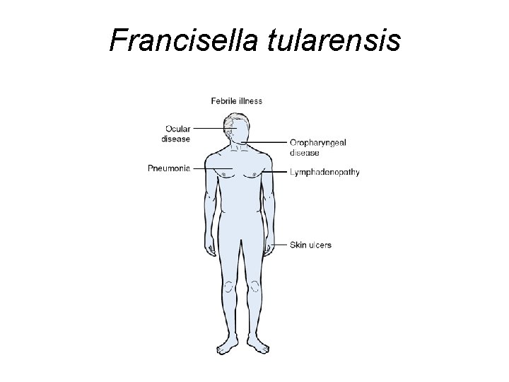 Francisella tularensis 