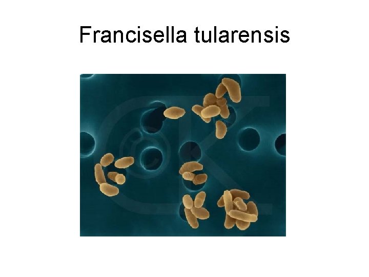 Francisella tularensis 