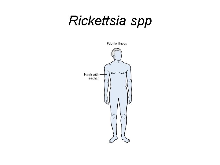 Rickettsia spp 