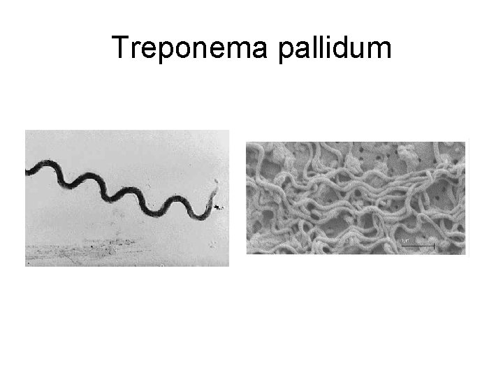 Treponema pallidum 