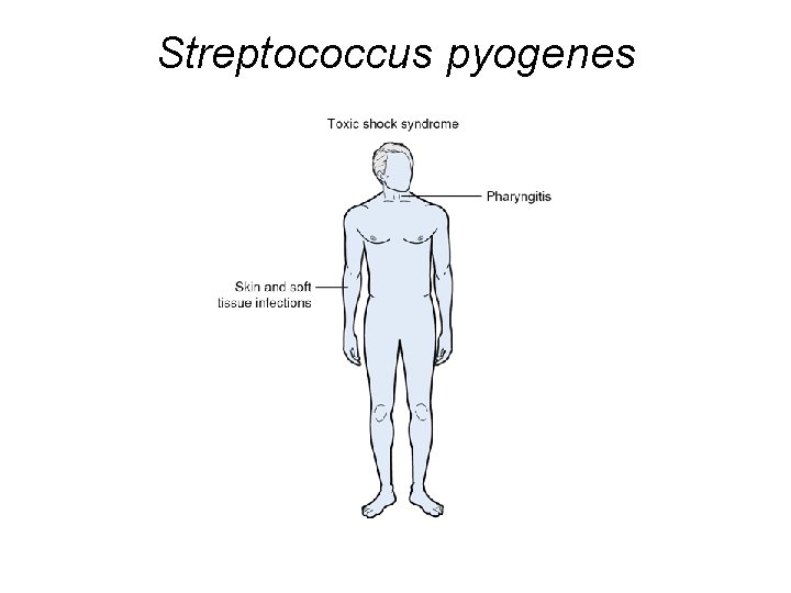 Streptococcus pyogenes 