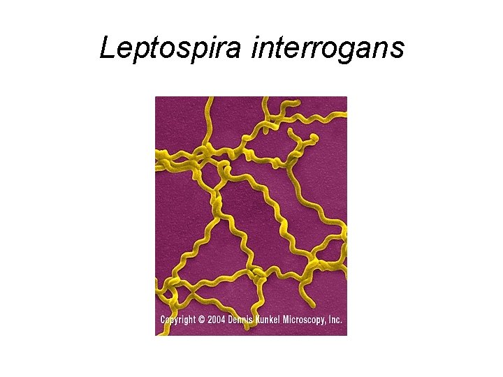 Leptospira interrogans 