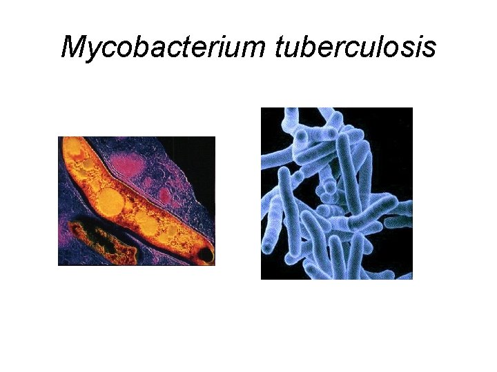 Mycobacterium tuberculosis 