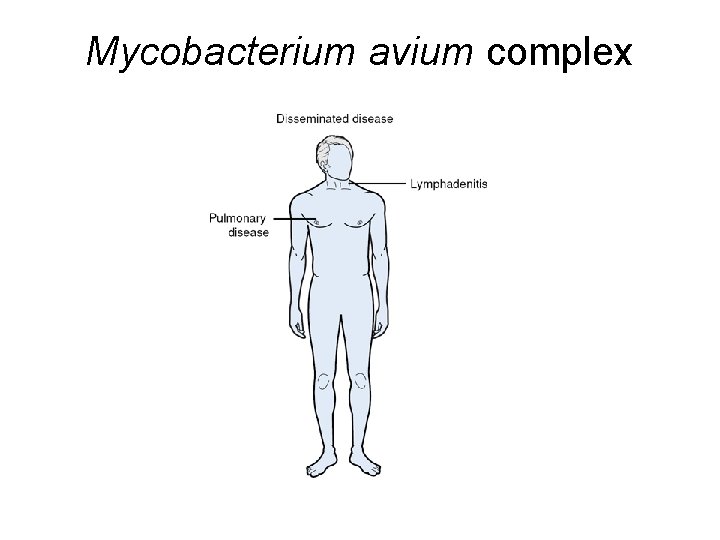 Mycobacterium avium complex 