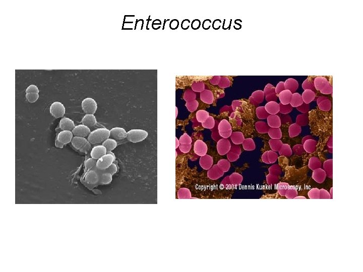 Enterococcus 