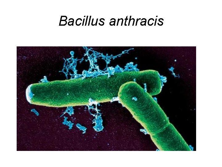 Bacillus anthracis 