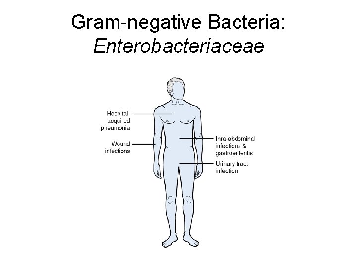 Gram-negative Bacteria: Enterobacteriaceae 