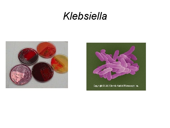 Klebsiella 