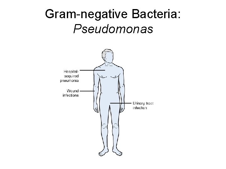 Gram-negative Bacteria: Pseudomonas 