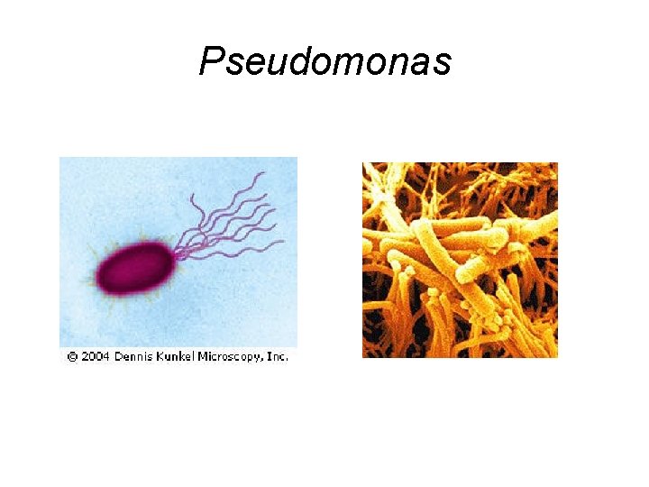 Pseudomonas 