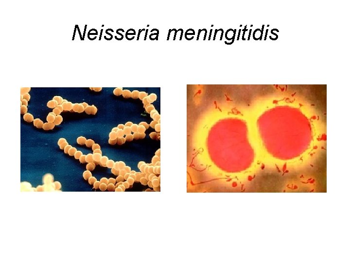 Neisseria meningitidis 