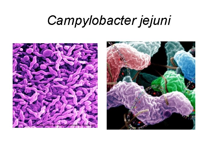 Campylobacter jejuni 