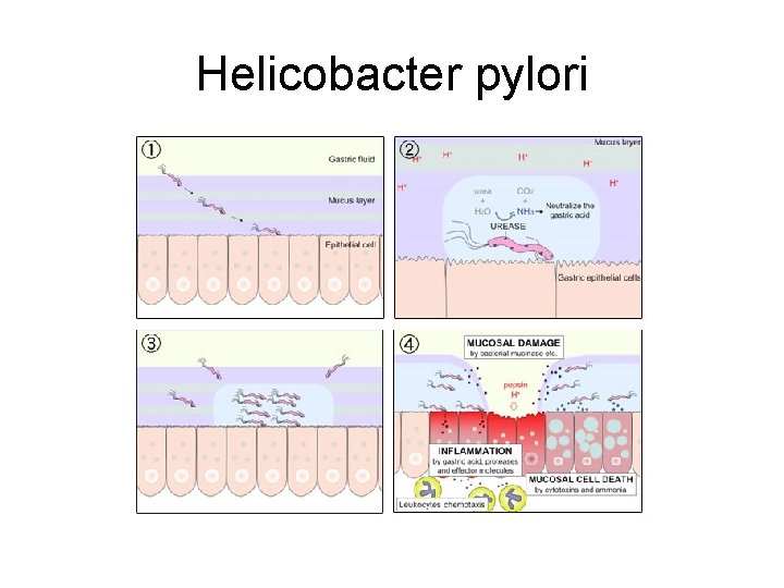 Helicobacter pylori 