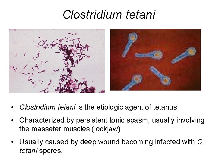 Clostridium tetani • Clostridium tetani is the etiologic agent of tetanus • Characterized by