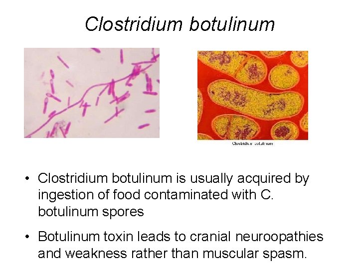 Clostridium botulinum • Clostridium botulinum is usually acquired by ingestion of food contaminated with