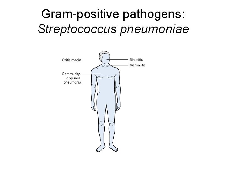Gram-positive pathogens: Streptococcus pneumoniae 