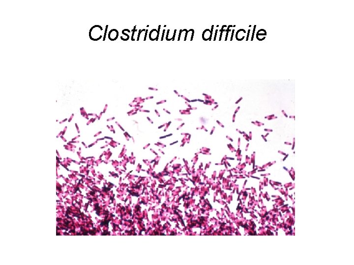 Clostridium difficile 