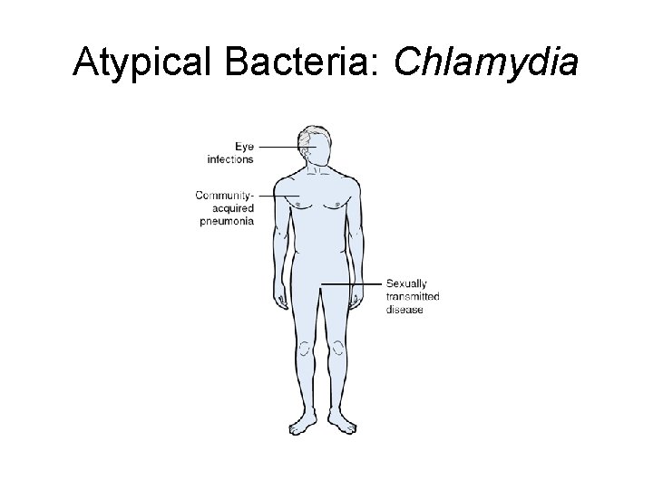 Atypical Bacteria: Chlamydia 