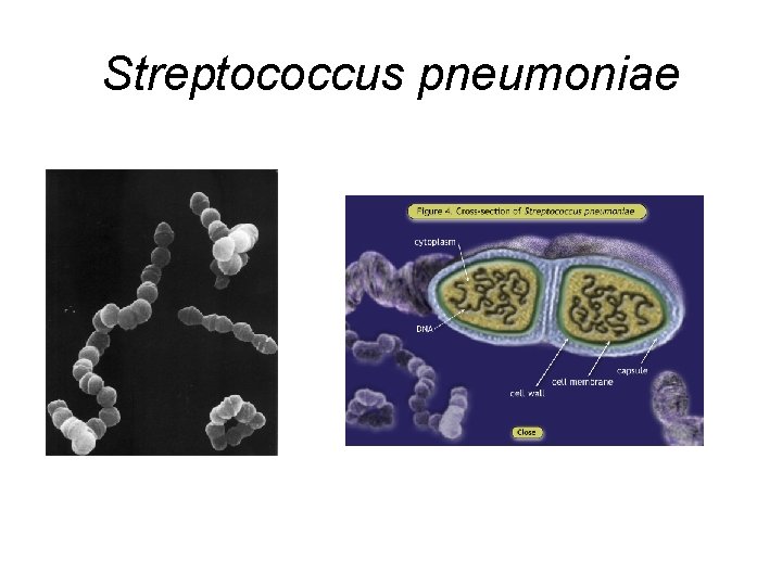 Streptococcus pneumoniae 