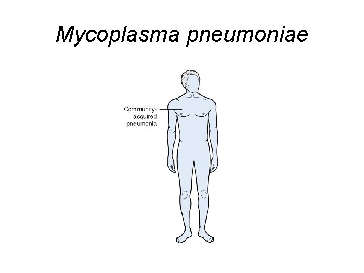 Mycoplasma pneumoniae 