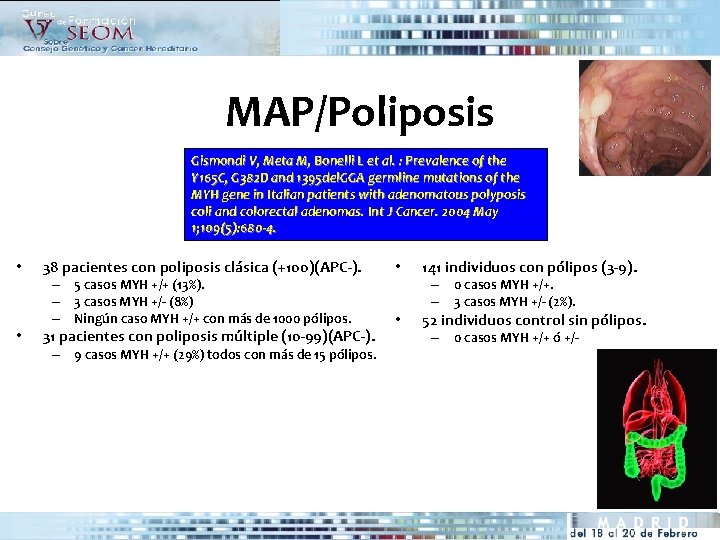 MAP/Poliposis Gismondi V, Meta M, Bonelli L et al. : Prevalence of the Y