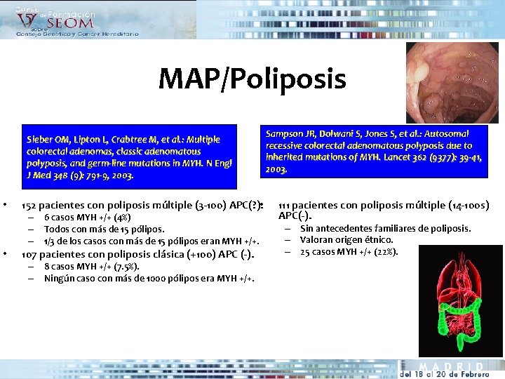 MAP/Poliposis Sieber OM, Lipton L, Crabtree M, et al. : Multiple colorectal adenomas, classic