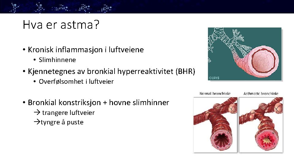 Hva er astma? • Kronisk inflammasjon i luftveiene • Slimhinnene • Kjennetegnes av bronkial