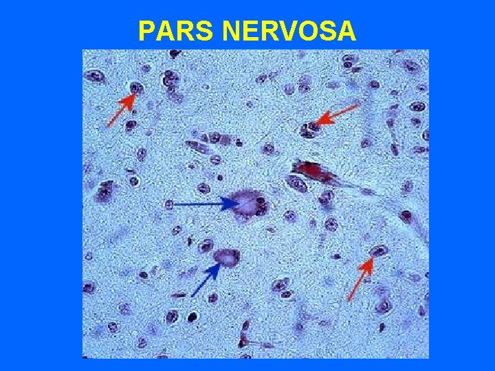 PARS NERVOSA PARS NERVOSA