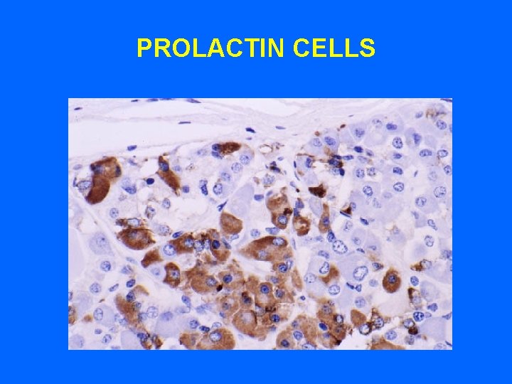 PROLACTIN CELLS PROLACTIN CELLS