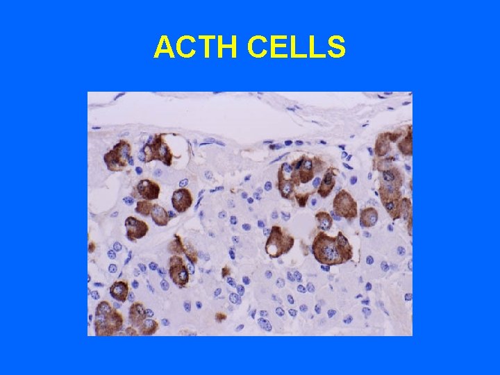 ACTH CELLS ACTH CELLS