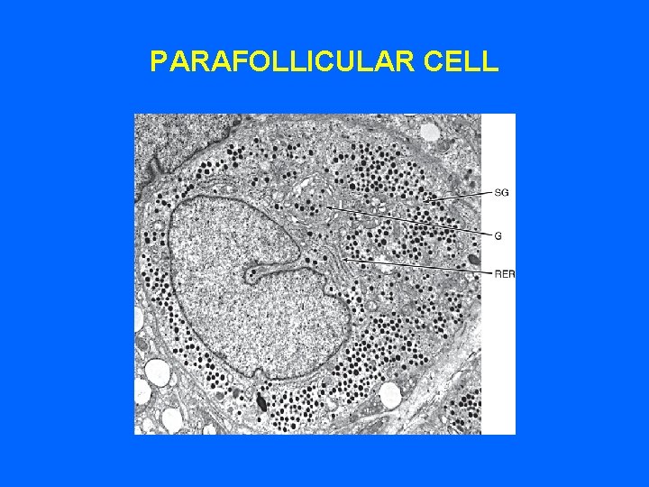 PARAFOLLICULAR CELL PARAFOLLICULAR CELL