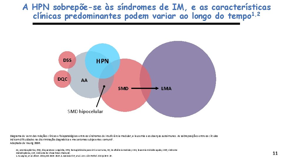 A HPN sobrepõe-se às síndromes de IM, e as características clínicas predominantes podem variar