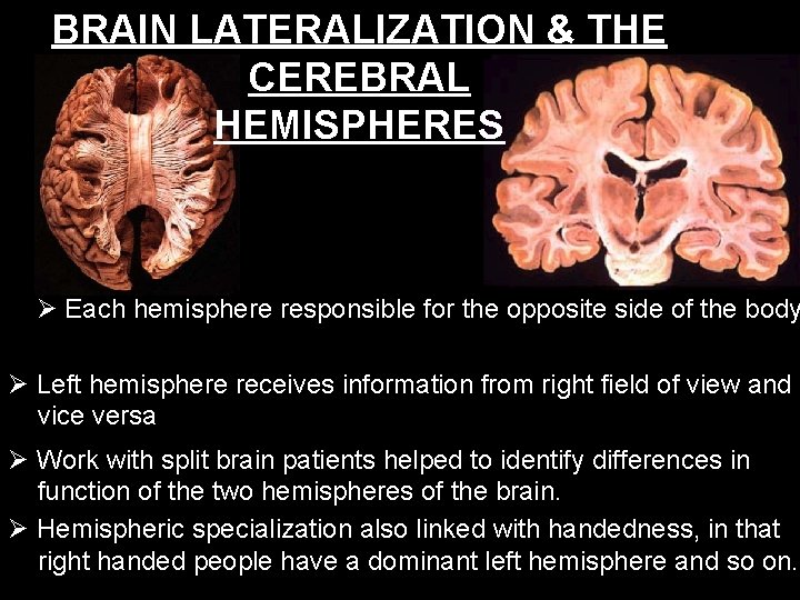 BRAIN LATERALIZATION & THE CEREBRAL HEMISPHERES Each hemisphere responsible for the opposite side of