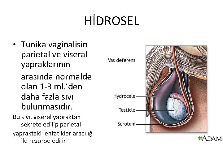 HİDROSEL • Tunika vaginalisin parietal ve viseral yapraklarının arasında normalde olan 1 -3 ml.