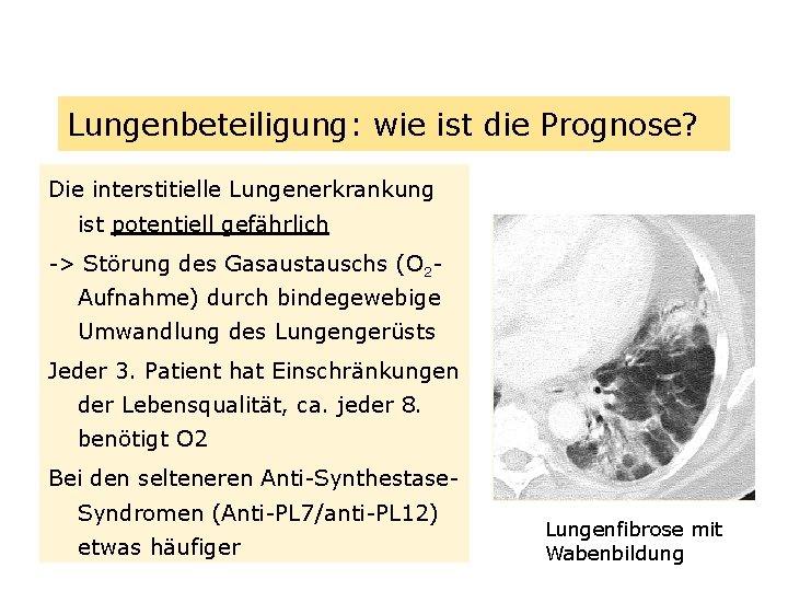Lungenbeteiligung: wie ist die Prognose? Die interstitielle Lungenerkrankung ist potentiell gefährlich -> Störung des