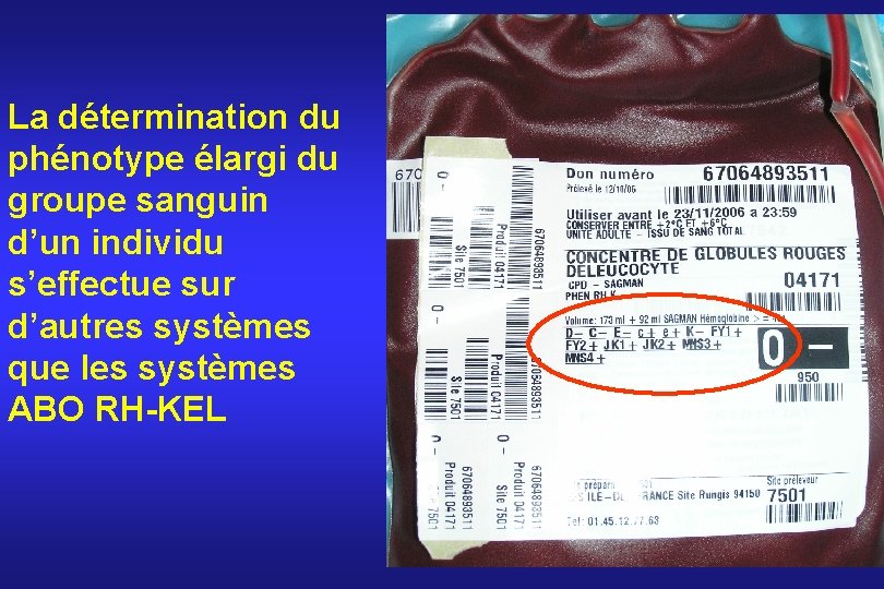 La détermination du phénotype élargi du groupe sanguin d’un individu s’effectue sur d’autres systèmes