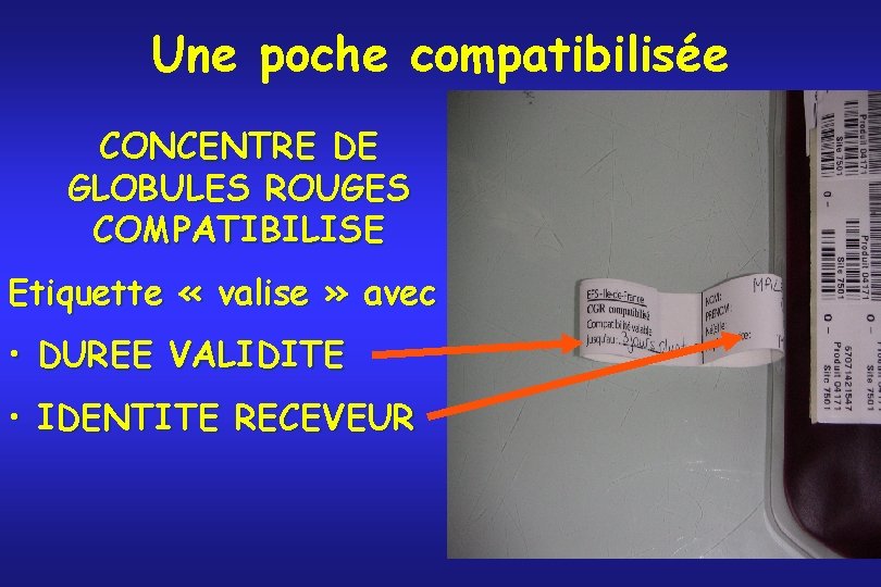 Une poche compatibilisée CONCENTRE DE GLOBULES ROUGES COMPATIBILISE Etiquette « valise » avec •