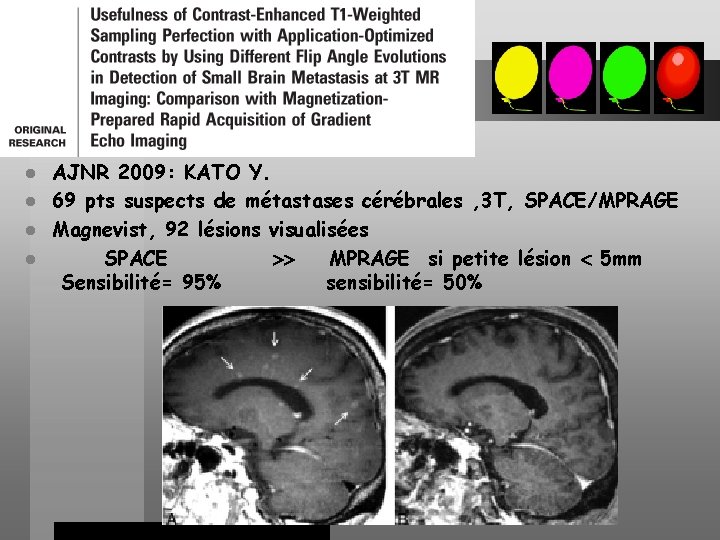 AJNR 2009: KATO Y. l 69 pts suspects de métastases cérébrales , 3 T,