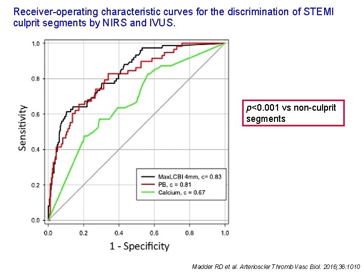 Receiver-operating characteristic curves for the discrimination of STEMI culprit segments by NIRS and IVUS.