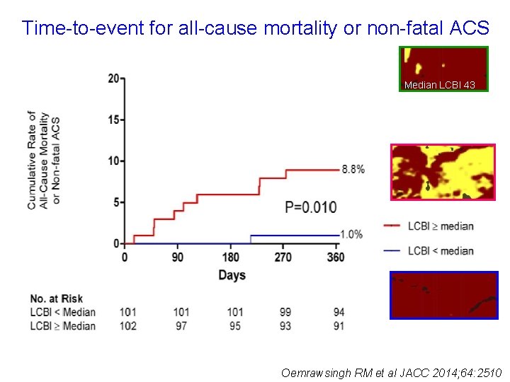 Time-to-event for all-cause mortality or non-fatal ACS Median LCBI 43 Oemrawsingh RM et al