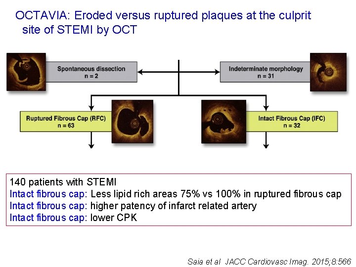 OCTAVIA: Eroded versus ruptured plaques at the culprit site of STEMI by OCT 140